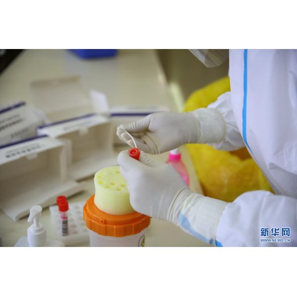 UN2814 UN3373 Infecious Specimen Cold Chain Safety Transportation Cooler Box