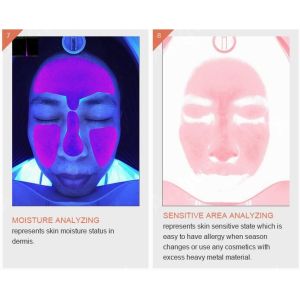 Skincare Wrinkle Pigmentation Acne Skin Analyser Machine 3D Smart Quizzes