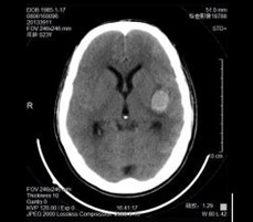 Konida Thermal Printer Fuji X Ray Film , Agfa Drystar Dt2b Film