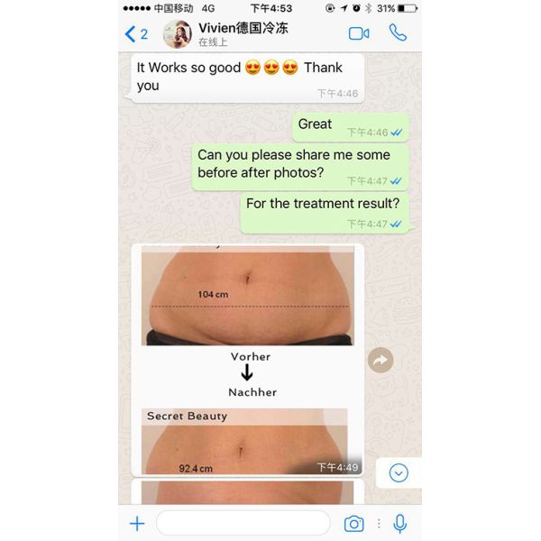 Beautiful Design High Quality Manufacturer Direct Sale Portable Cryolipolysis Machine For