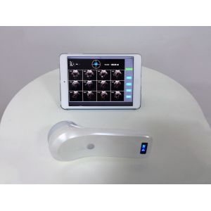 Portable 4D Wireless Bladder Scanner WIFI Ultrasound Probe for Evaluation of