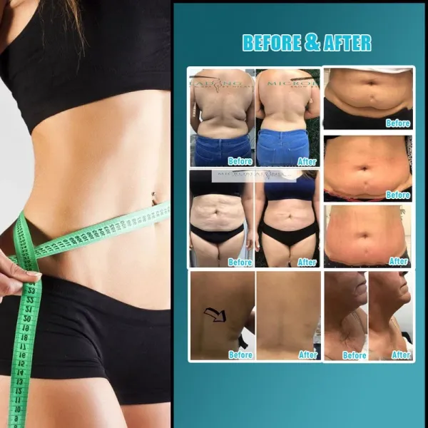 product-800-800 Vela Body Shape Machine RF Vaccum Technology For Skin And Body