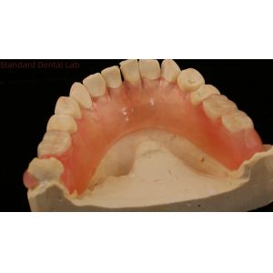 Dental TCS Valplast Flexible Partial Dentures Nesbit Valplast Finish China