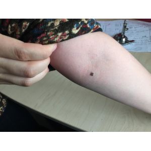 Professional Electronic Video Dermatoscope Skin Inspecter With Micro SD Card