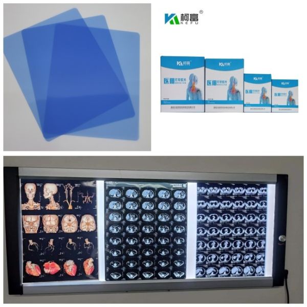 PET Film Base Blue Transparent Color Medical X ray films for X-ray Diagnosis