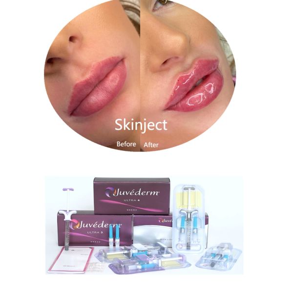 Buy Juvederm Hyaluronic Acid Facial Dermal Filler Injectable 2*1ml Packing at wholesale prices