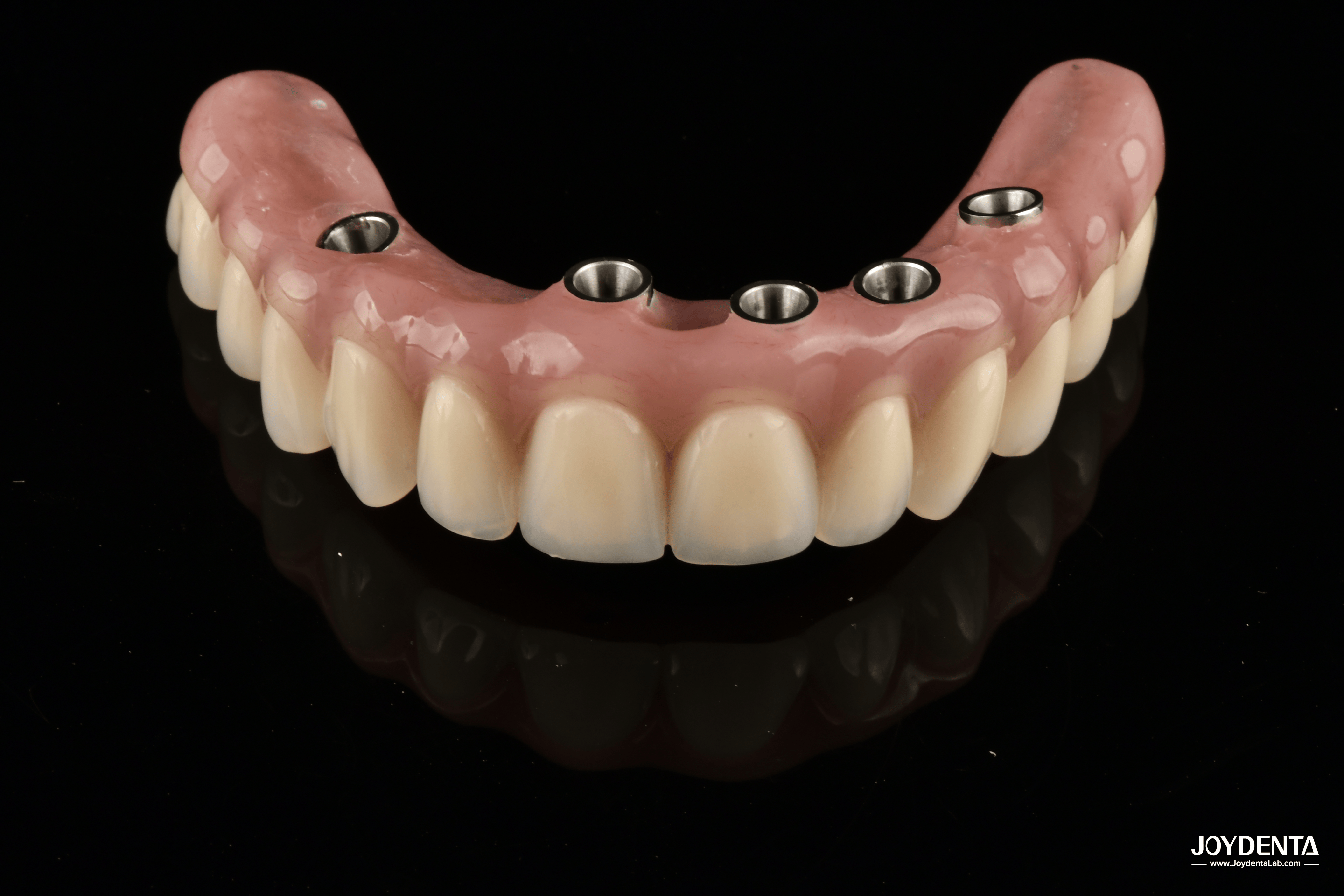 China Redefining Full Arch Prosthetics: Unmatched Fit and Function with Our Ti-Base Complete Dentures on sale