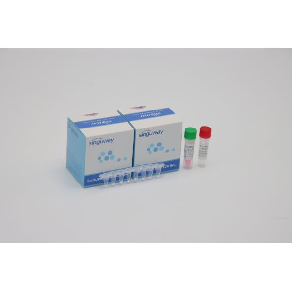 Buy HIV Virus Quantitative Fluorescent PCR Detection Kit POCT Real Time CE at wholesale prices