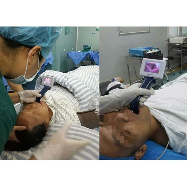 Operating Easily Flexible Portable Video Laryngoscope Indirect Laryngoscope With Monitor