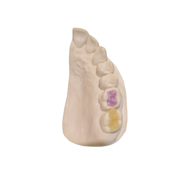 Buy Custom High-Density Custom Dental Ceramics FDA All-Ceramic Crown at wholesale prices