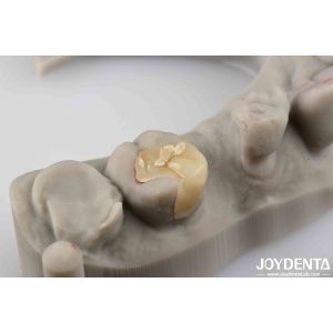 Strong Resistance To Fracture Emax Inlay Onlay Natural-looking Esthetics And