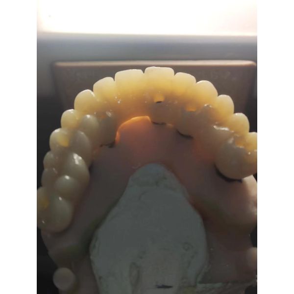 Dental Sintering CAD CAM Zirconia Blocks Translucent Multilayer A3.5 98*22mm