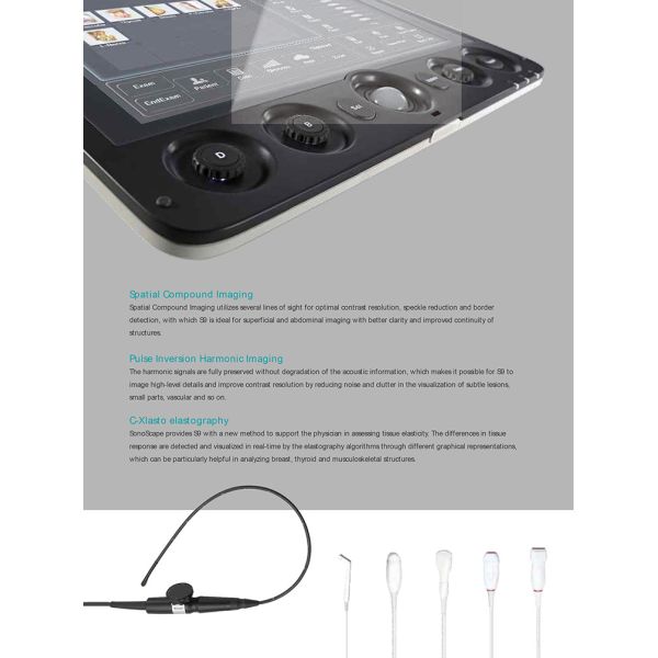 Sonoscape S9 Pregnant Baby Medical Diagnosis 4D Color Doppler Sonography Machine Portable Ultrasound