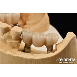 Zirconia Implants Perfect Match With Natural Teeth Zero Allergy Risk