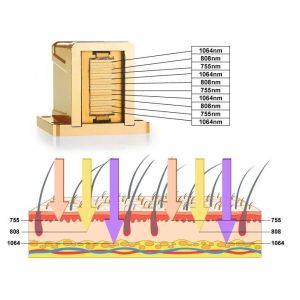 Professional 808nm Diode Laser Hair Removal Machine Permanent Painless