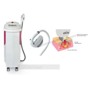 Vertical SHR Intense Pulsed Light Hair Removal Machine Large Spot Size High Efficiency