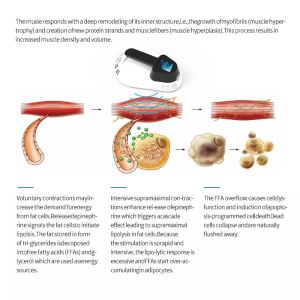 13 Tesla Body Sculpting Muscle Stimulating Building High Efficiency 4000va