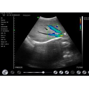 Hand Held Ultrasound Wireless 10mhz Doppler Probe