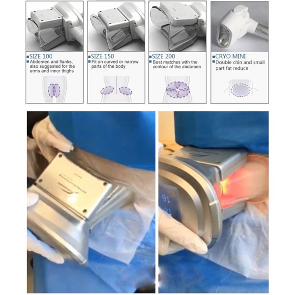 12V Cool Mini Fat Reduction Cryolipolysis Slimming Machine