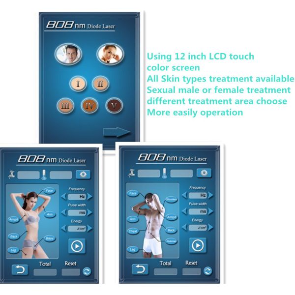 Most Effective!! HIgh Quality Permanent hair removal laser machine