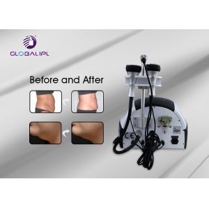 Automatic Ultrasonic Portable Cavitation Slimming Machine 1000W Output Power