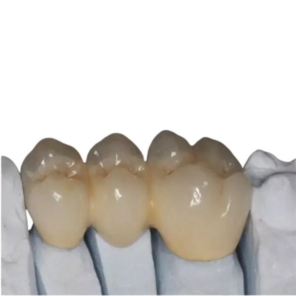 Buy OEM Customized Zirconia Porcelain Teeth High Strength Durable Beautiful at wholesale prices