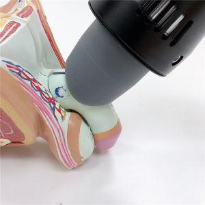 ESWT Therapy Radial Stone Blasting Machine For ED Treatment