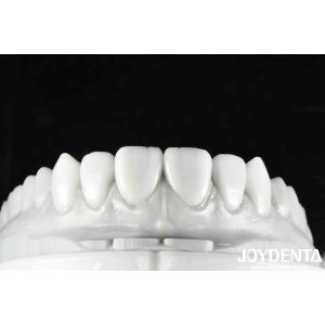 Flexible Denture Finish Revolutionize Your Dental Practice With Natural Tooth