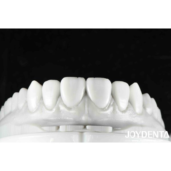 Flexible Denture Finish Revolutionize Your Dental Practice With Natural Tooth