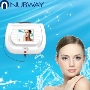 High Frequency Vascular Spider Veins Removal Machine With Digital Control