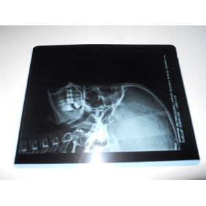 Konida Low Fog Medical Dry Imaging Film For X Ray Examination