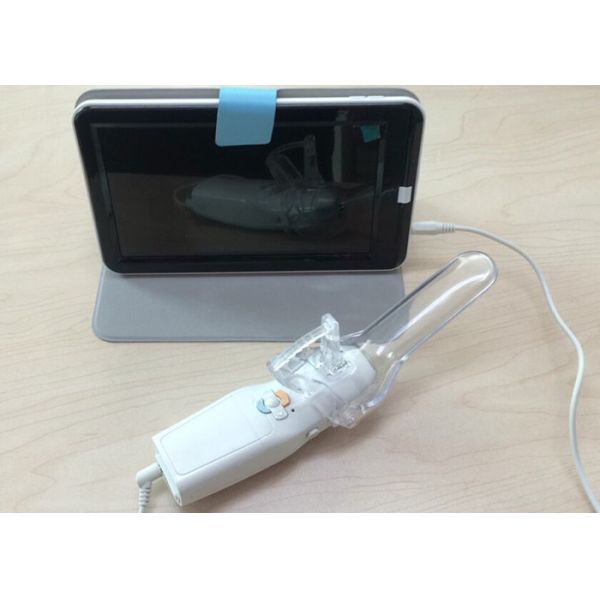 High Definition Women Self-Examination Endoscope AV ( video ) Signal Digital
