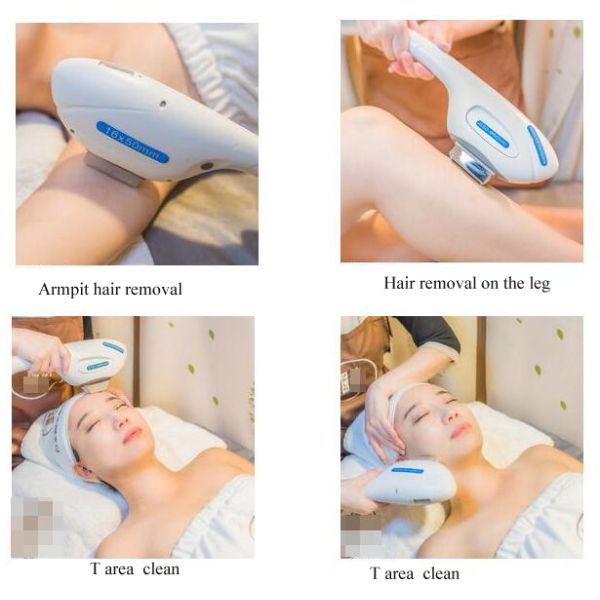 Nd Yag Laser Multifunction fat freezing machine With Intelligent Operating System