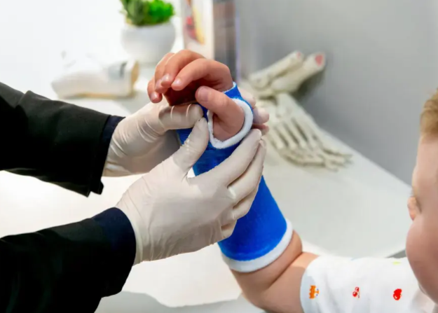 Orthopedic Casting bandage Fiberglass Casting Orthopedic Immobilization and Cast Care