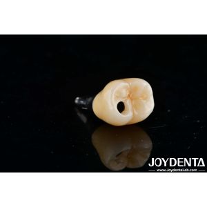 Internal Hex Titanium Dental Implants Precision Machining With Zero Angulation