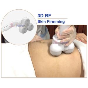 10 In 1 Cavitation Slimming Machine Rf 40K Cavitation Body Sculpting Vacuum