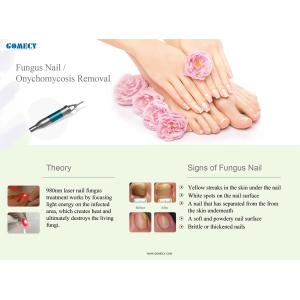 Triangel Laser Optic Fiber 980nm 1470nm Lipolysis Liposuction machine , 1470nm