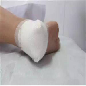 OEM Adhesive Foam Sterile Wound Dressing For Foot
