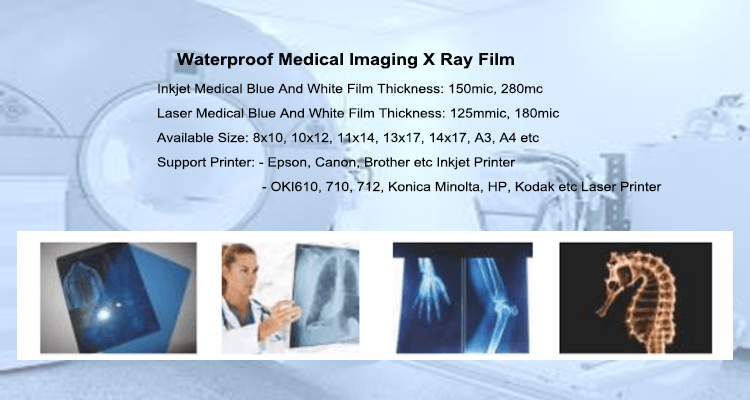 Image Inkjet Printing Blue Medical X Ray Film Double Coated Waterproof 280gsm