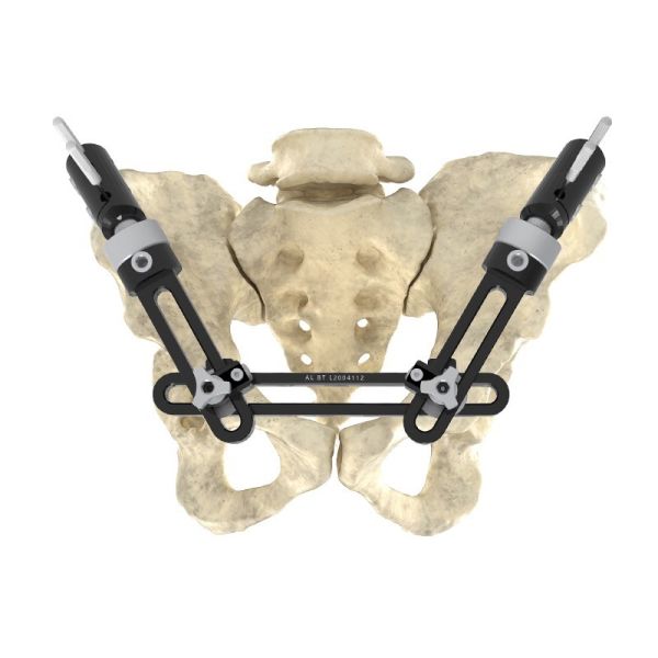 Buy Intra Articular Monolateral External Fixator Precise Single Arm External Fixator at wholesale prices