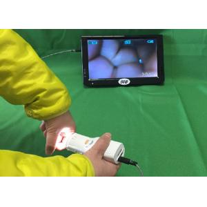 Quality Portable Digital Electronic Colposcope for sale