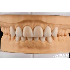Lightweight Property Flexible Denture Finish Personalized Customization For