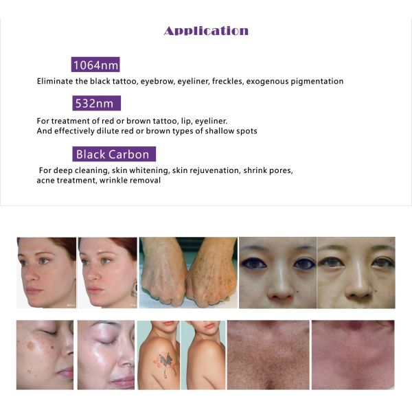 2 In 1 Nd Yag Laser+ 808 755 1064nm Diode Laser Hair Removal Machine Skin Rejuvenation Salon Beauty Equipment