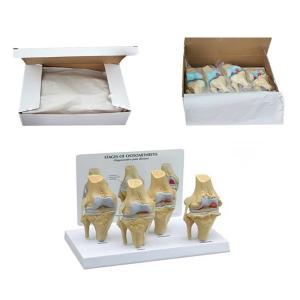 PVC Simulation Medical Skeleton Model Human Pathology Knee Anatomy Model