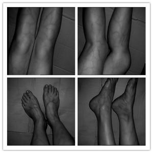 Blood Testing Equipments Infrared Veinviewer For Hospital Use