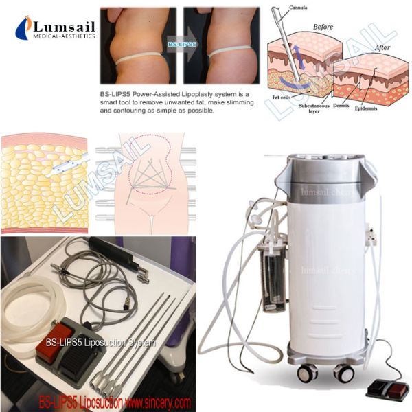 Buy Aesthetic Plastic Surgical Liposuction Machine Power Assisted 300W OEM / ODM at wholesale prices