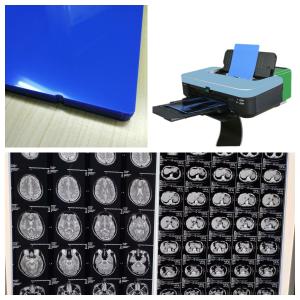 Quality Blue Transparent A3 A4 13X17 A3+ Film Reasonable Cost for sale