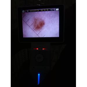 1920x1080 Digital Video Dermatoscope